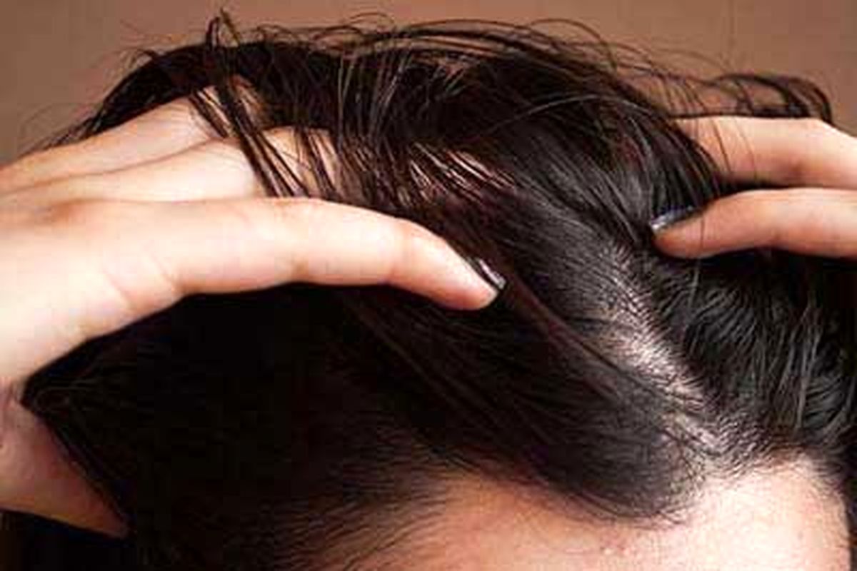 روش‌هایی برای خلاص شدن از موهای چرب