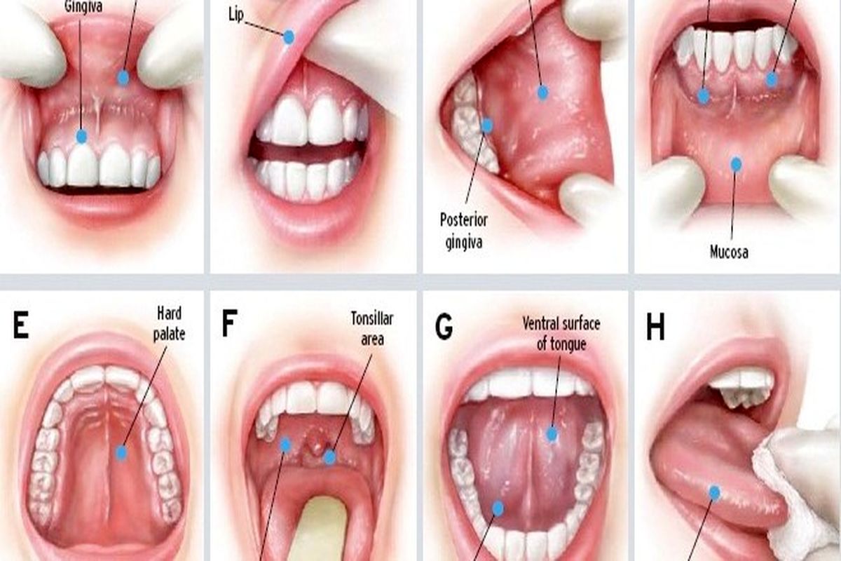 سرطان دهان در کمین افرادی که این ماده غذایی را نمی خورند