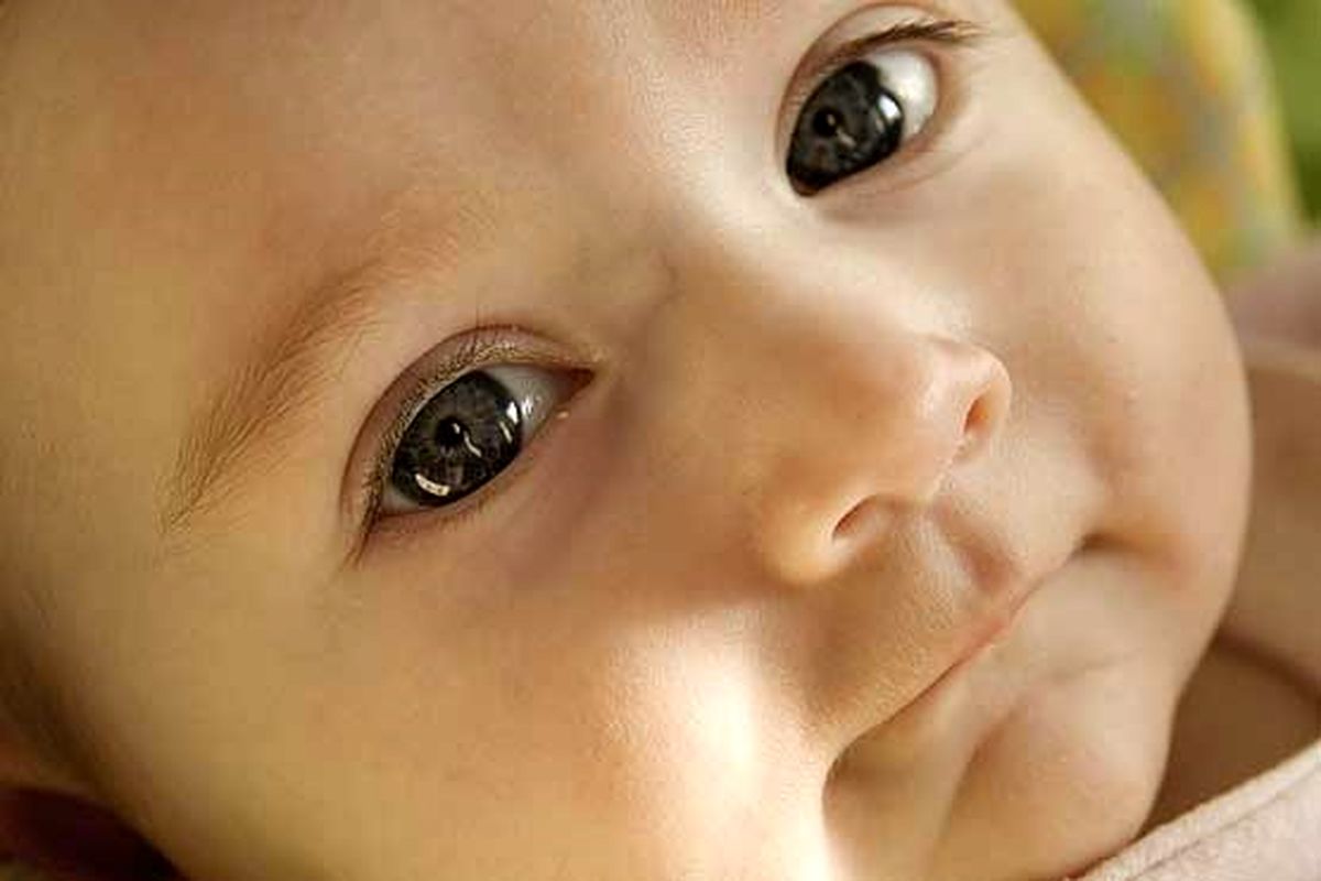تاخیر در درمان چشم نوزادان نارس، سبب نابینایی نوزاد می شود