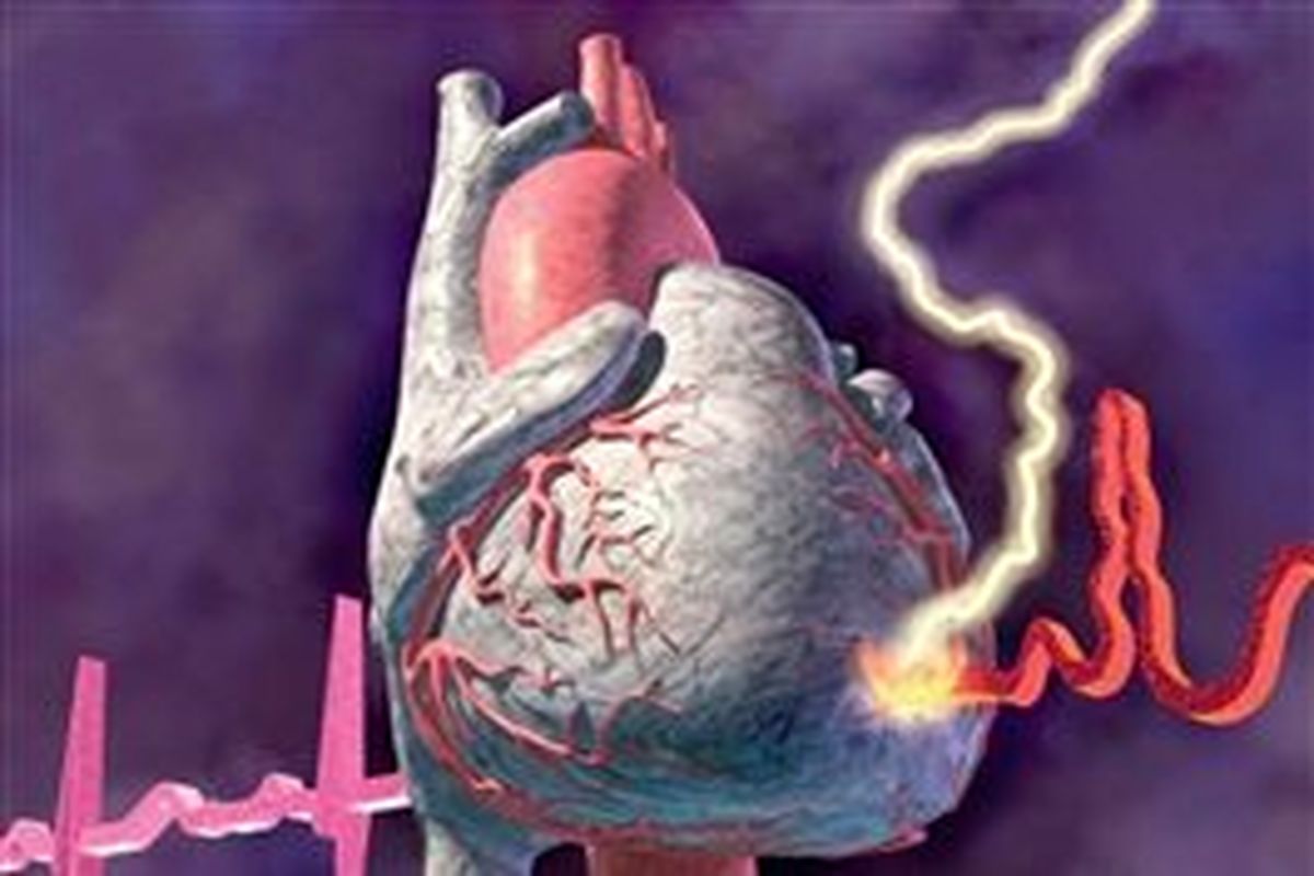 ورود نمونه های جدید دستگاه های ضربان ساز قلب به کشور