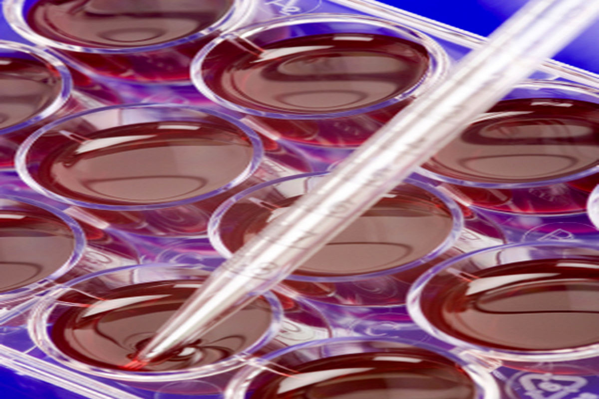 طرح‌های راهبردی داروهای پیوند سلول‌های بنیادی خونساز حمایت می‌شود