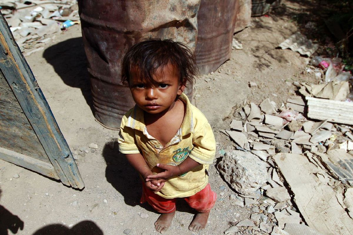 بیش از ۲ میلیون کودک یمنی دچار سوء تغذیه حاد هستند/ این سوء تغذیه کودکان یمنی را می کشد