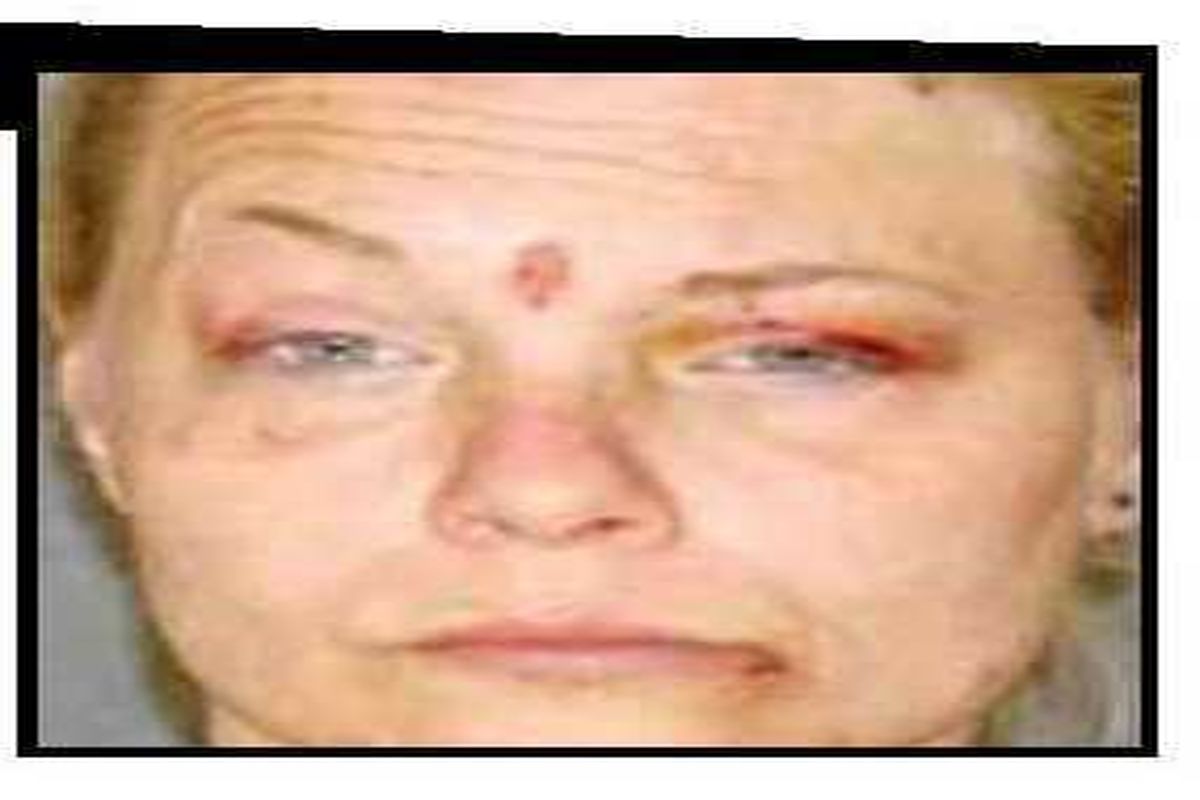 زن معتاد شوهرش را با دندان تکه تکه کرد