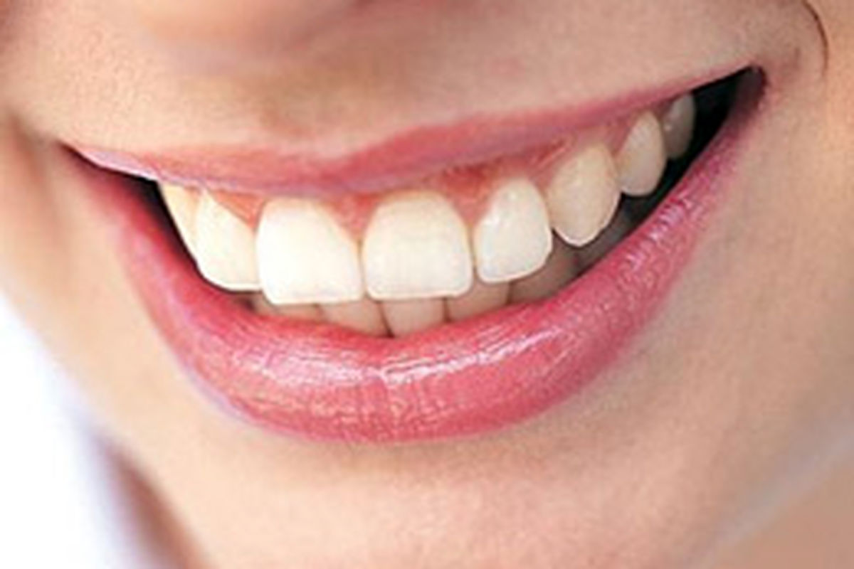 کاهش ۱۸ درصدی مراجعه به دندانپزشک در بیمارستان تامین اجتماعی