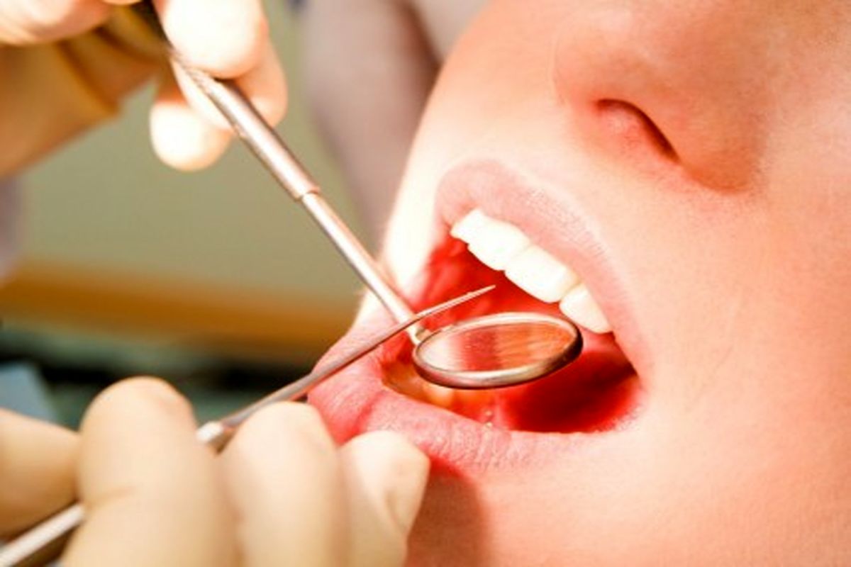 آمار دقیقی از خطاهای دندانپزشکان نداریم/ پوسیدگی دندانی در کشور بالاست