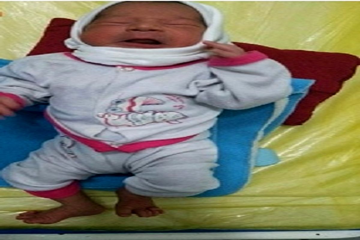تولد نوزاد با ۲۴ انگشت در گناباد