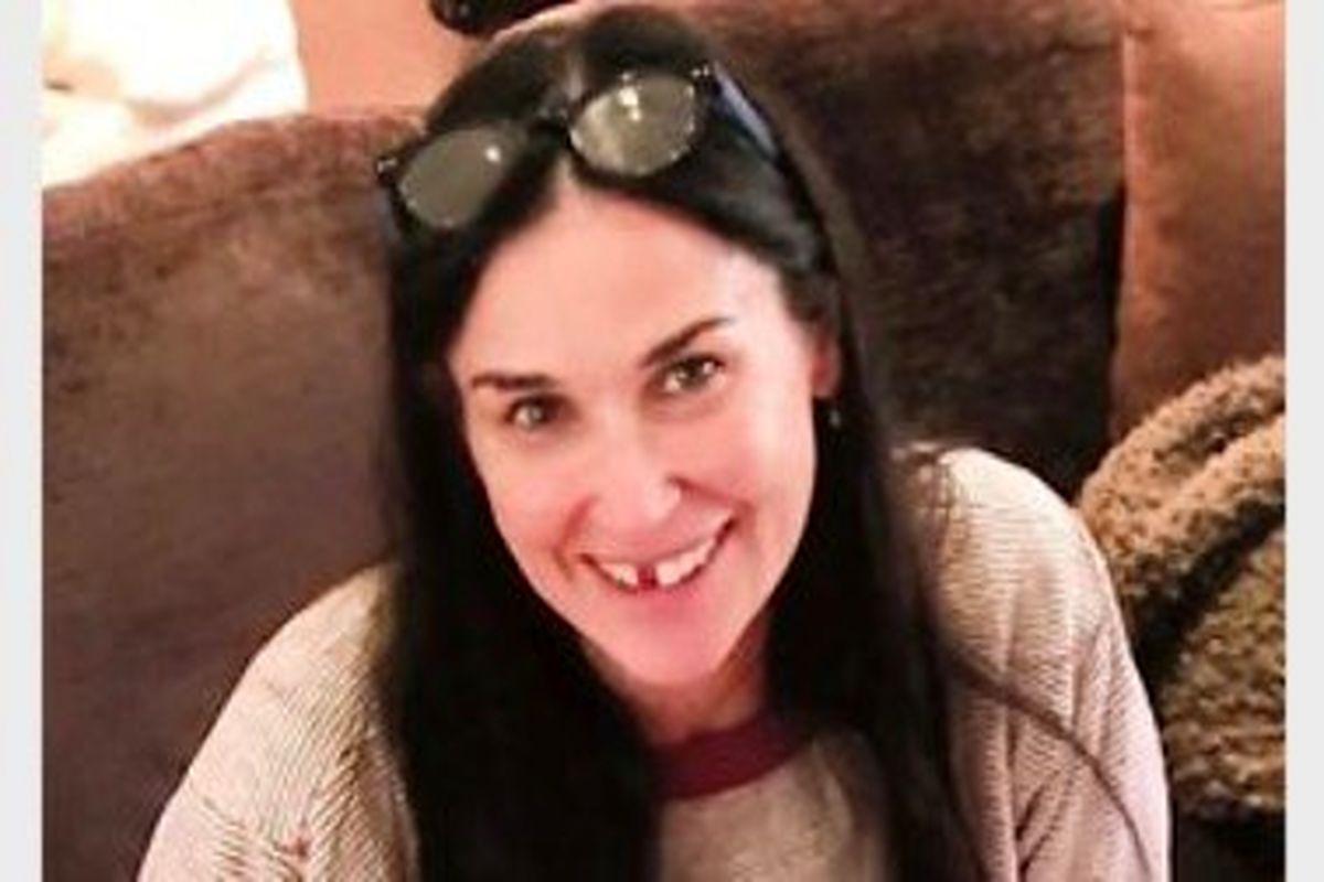 افتادن دندان بازیگر زن سرشناس بخاطر استرس!/ببینید