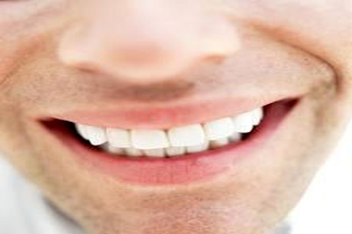 بدون مراجعه به پزشک دندان‌ها را جرم‌گیری و سفید کنید