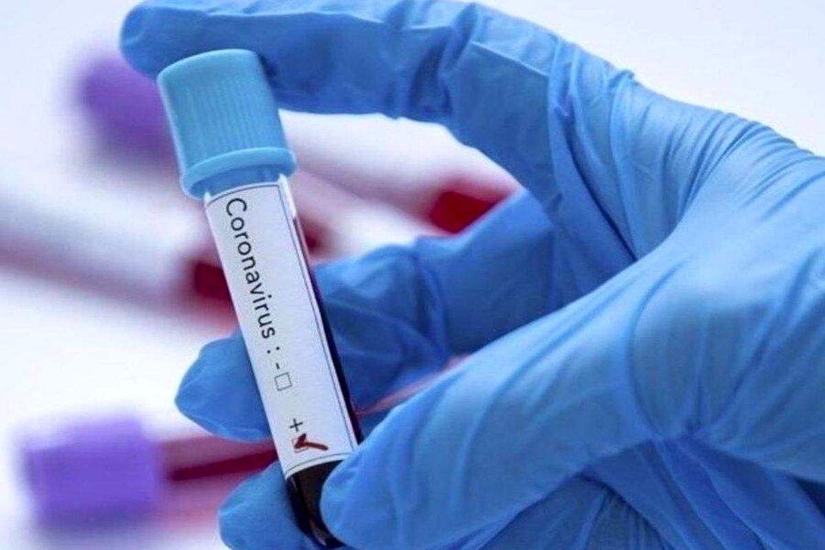 احتمال آلودگی یک آزمایشگاه سازنده کیت‌های تست کروناویروس