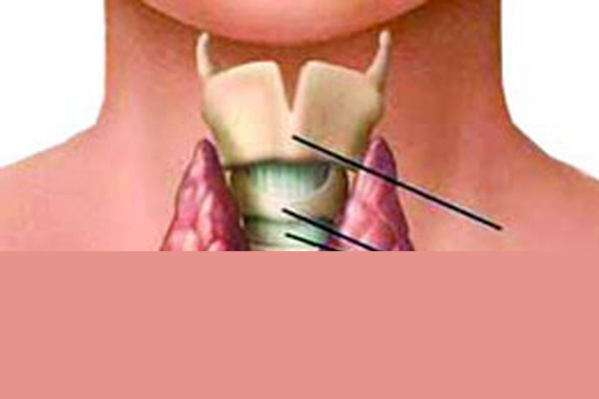 نشانه های کم کاری و پر کاری تیروئید!