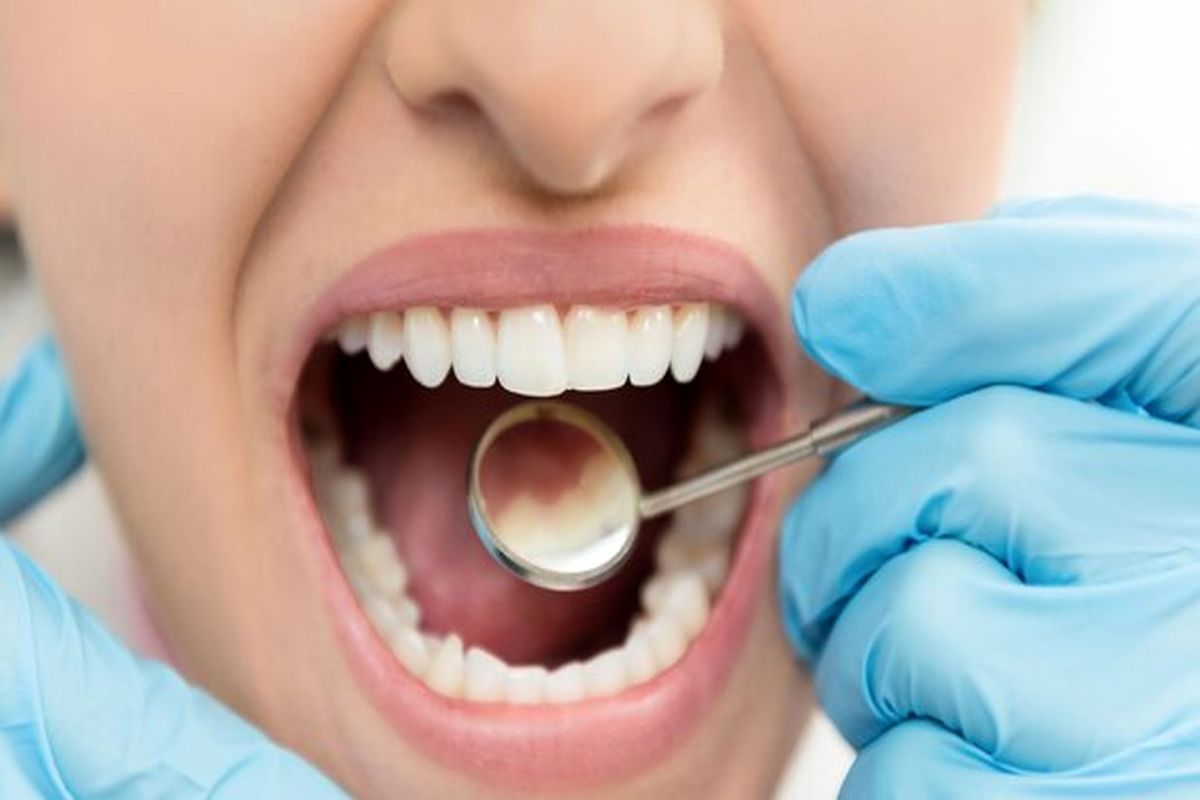عمر مفید ایمپلنت‌های دندانی ۱۰ سال است