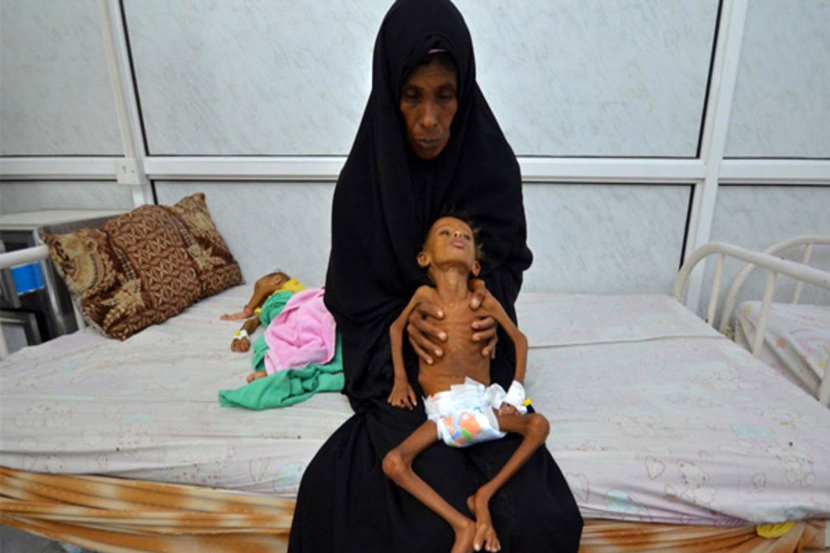 هر ۱۱ دقیقه یک کودک در یمن می‌میرد