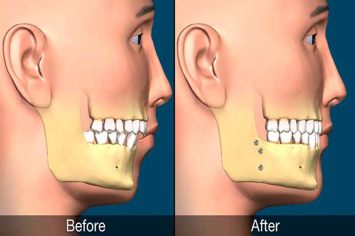 جراحان دهان، فک و صورت خط اول درمان صحیح شکستگی‌های صورت