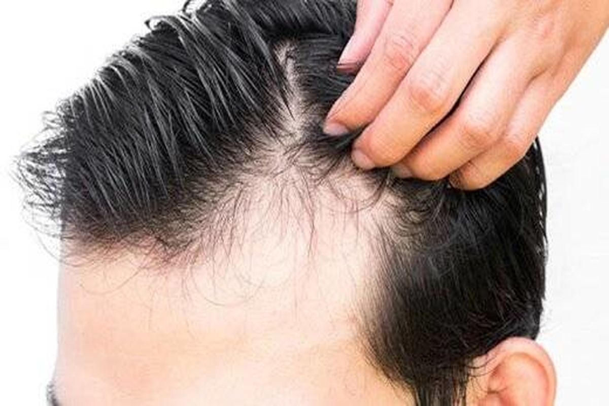 راهکارهای سنتی و عالی برای جلوگیری از ریزش مو