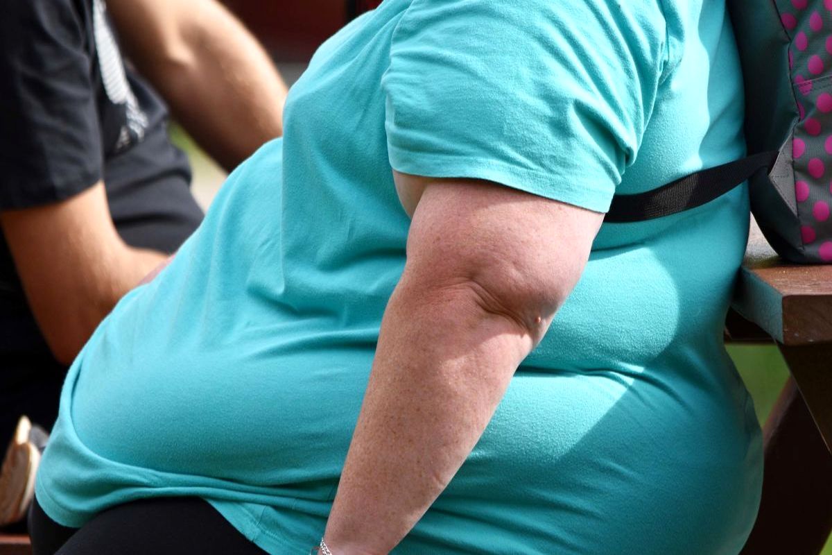 نیمی از مبتلایان به کرونا چاق و ۲۸ درصد دارای اضافه وزن هستند!