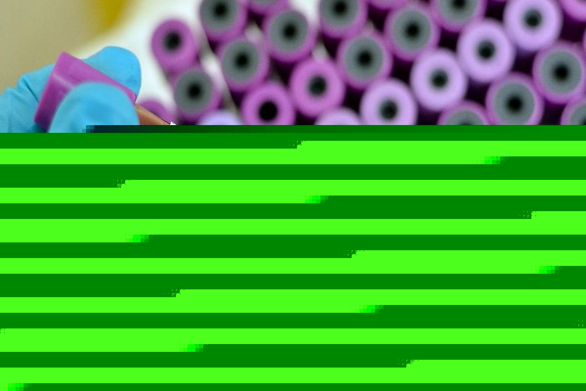 آخرین و جدیدترین آمار کرونایی استان مرکزی تا ۲۸ اسفند ۹۹