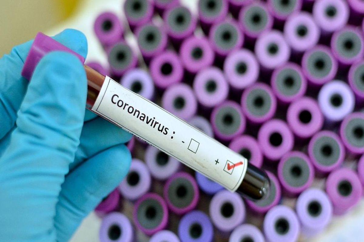 سه هزار و ۳۲۲ نفر در سیستان و بلوچستان به ویروس کرونا مبتلا شدند