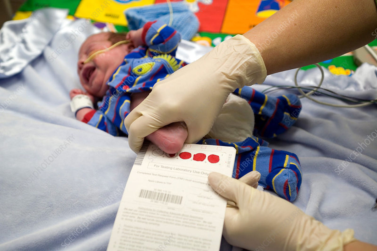 ۵۰ درصد والدین، آزمایش خون ابتلا به فنیل‌کتونوری را برای نوزادشان انجام نمی‌دهند