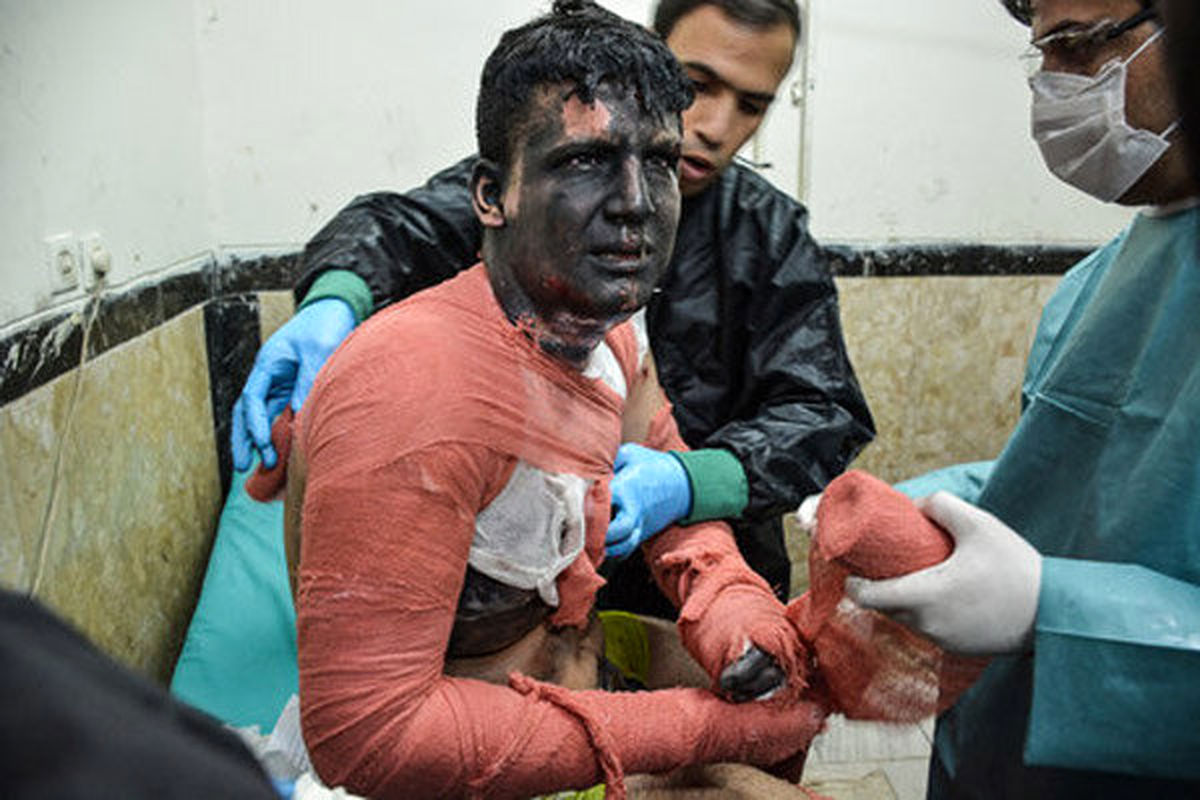 ۹۶ نفر در استان قزوین در حوادث چهارشنبه آخر سال مجروح شدند