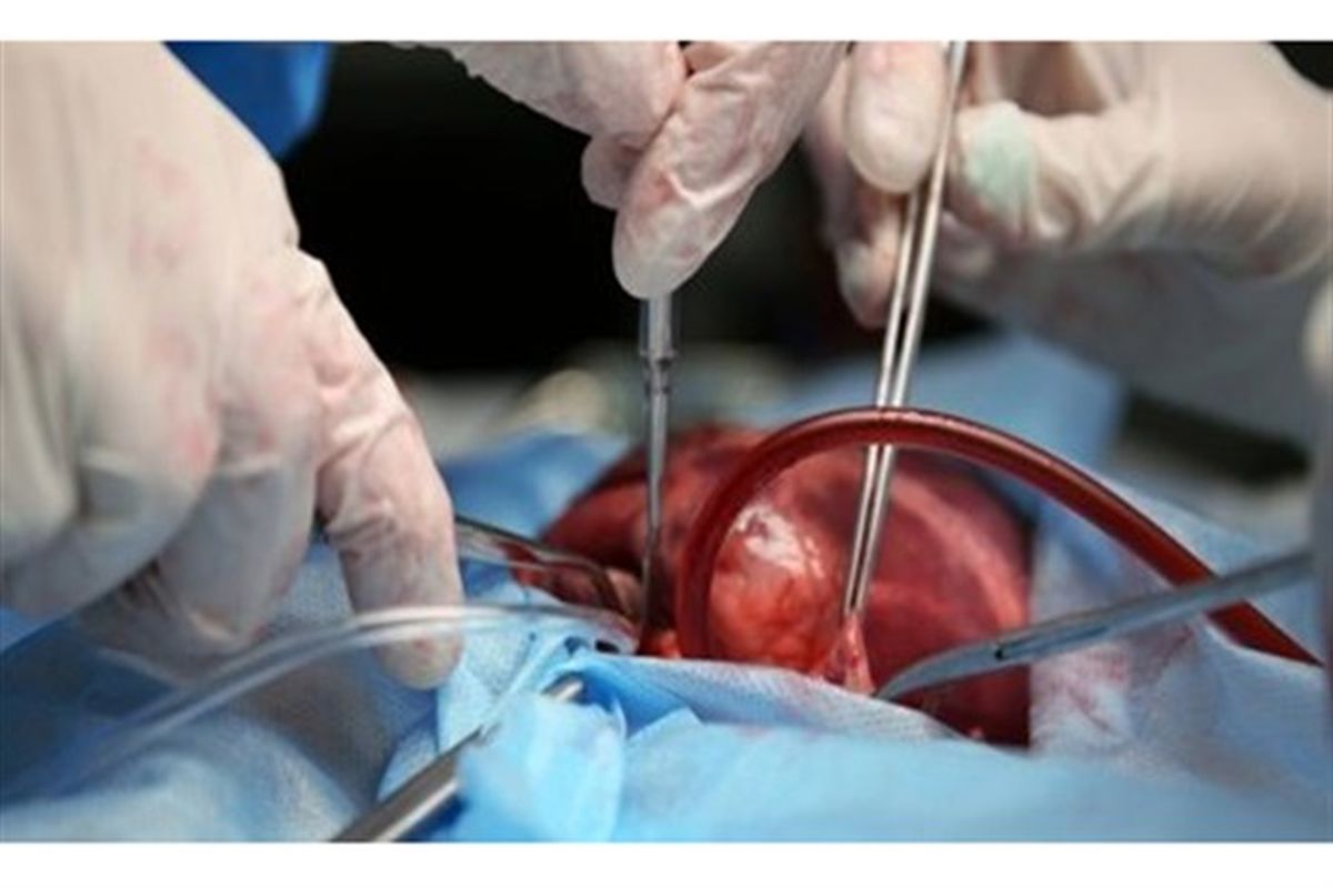 نجات جان ۵ نفر با اهدای عضو جوان مرگ مغزی مشهدی