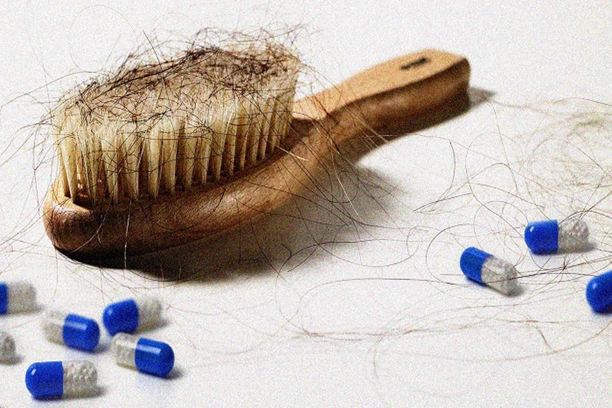 ۸ روش موثر برای درمان ریزش مو در بیماران کرونایی