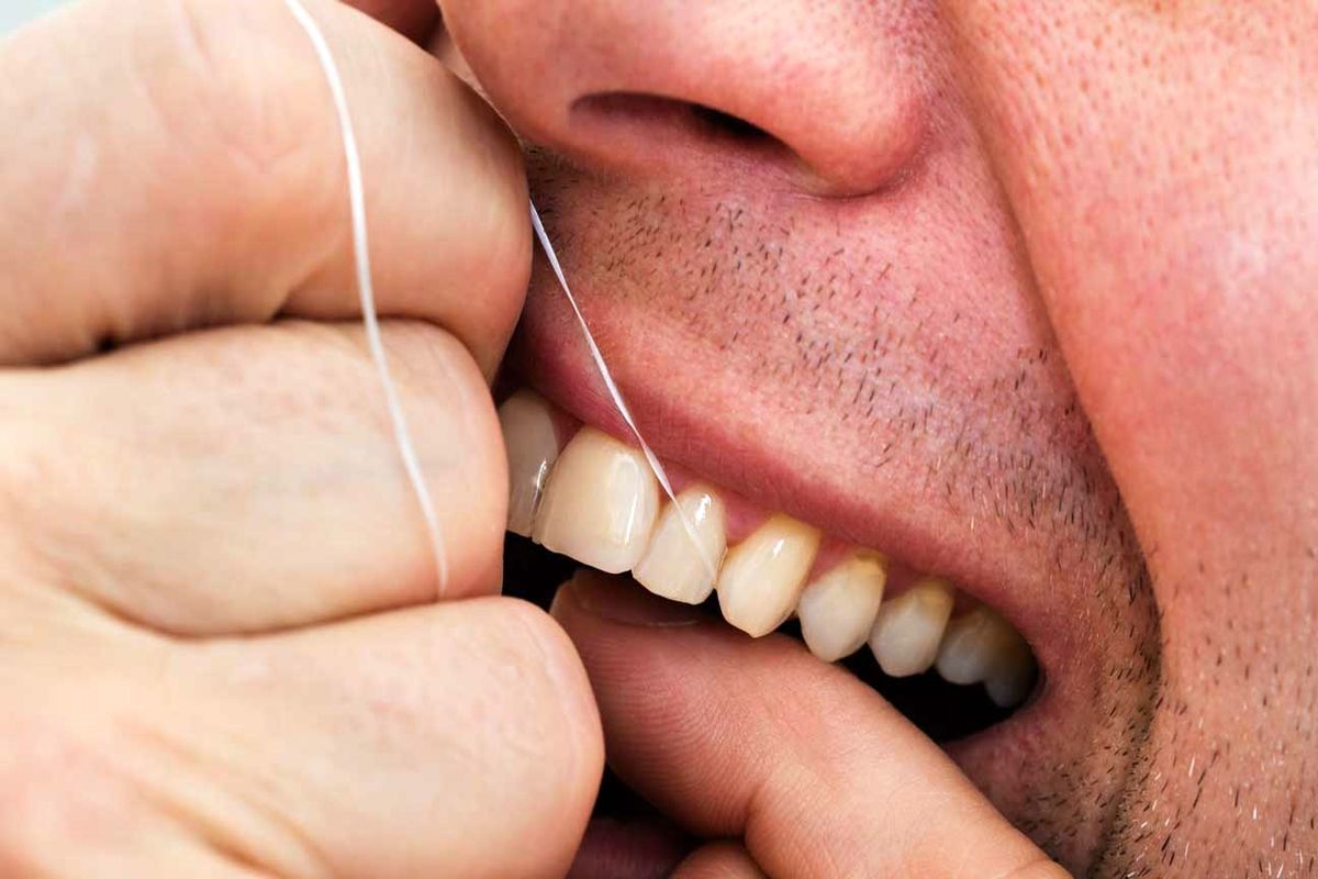 آیا واقعا نخ دندان از پوسیدگی دندان جلوگیری میکند؟