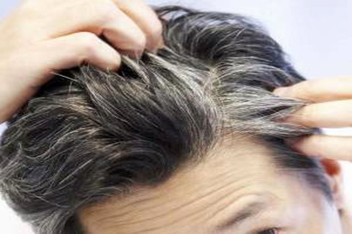 راهکار هایی برای کاهش سفیدی زودرس موی سر