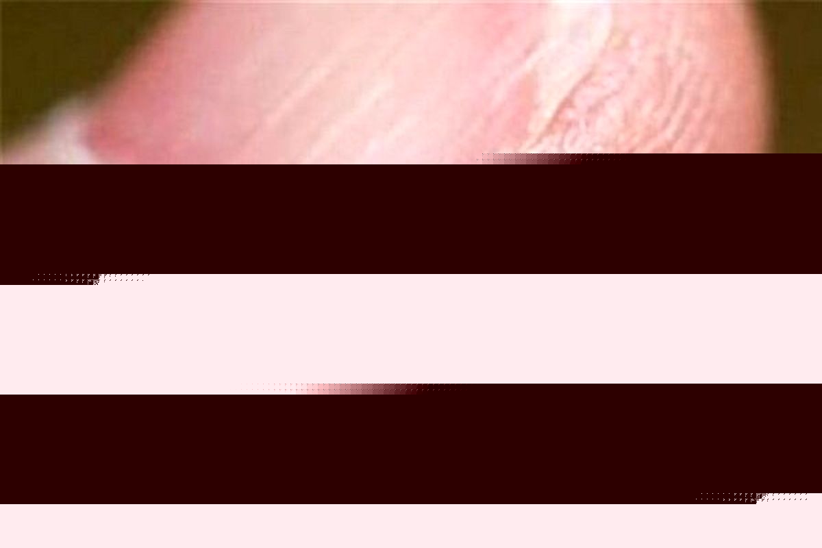 تب کریمه کنگو در این شهرستان شمالی کشور اوج گرفت!