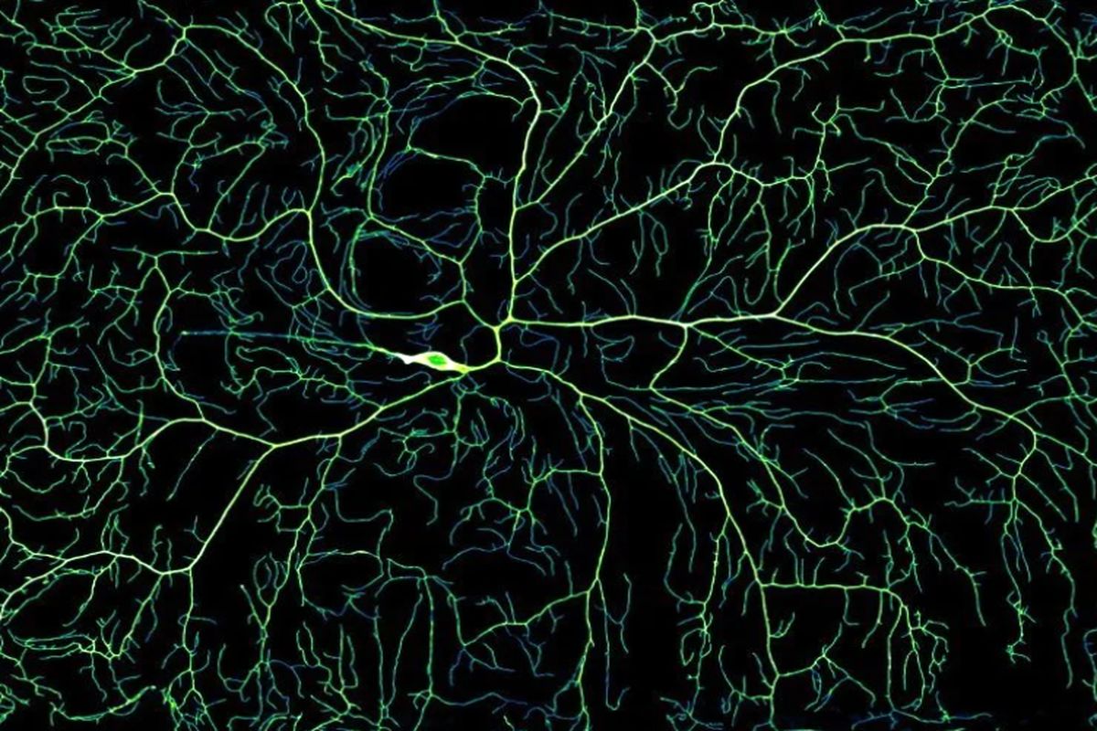 تصویرسازی عملیات پیچیدۀ عصبی مغز انسان