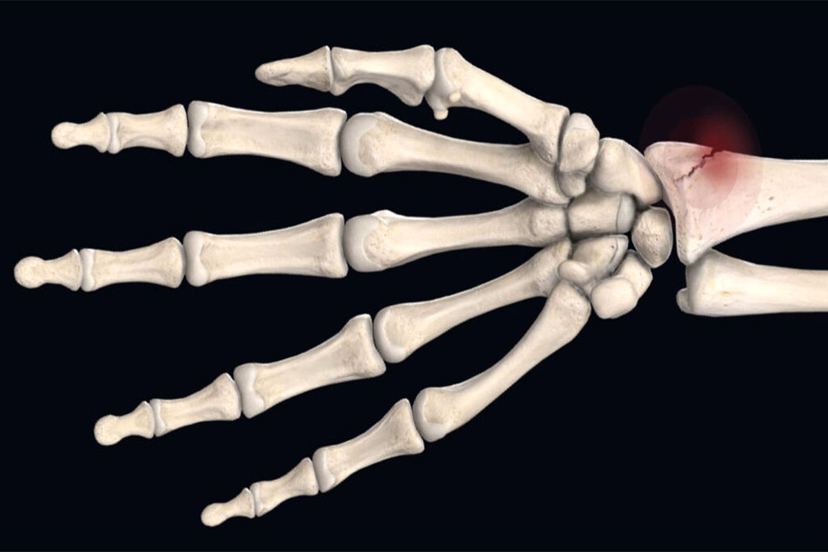 درمان دردهای استخوانی با کمک نانوفناوری