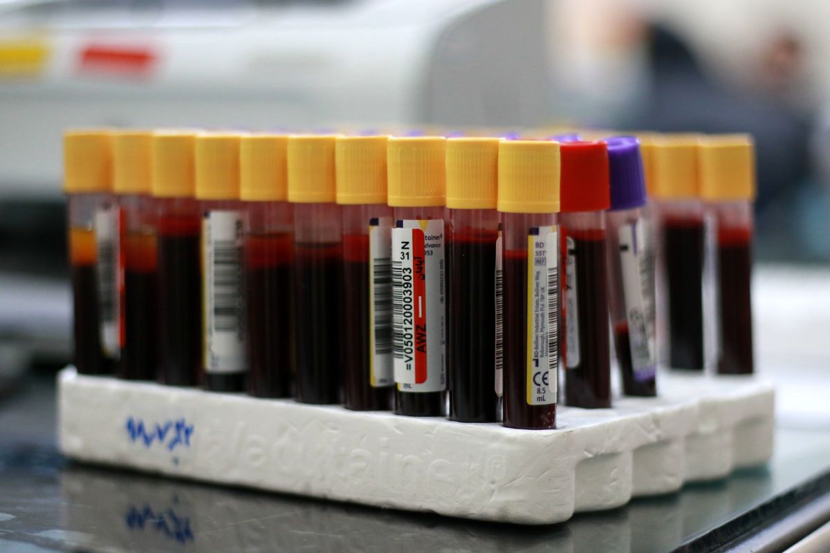 ذخیره فرآورده های خونی در ایران چقدر است؟