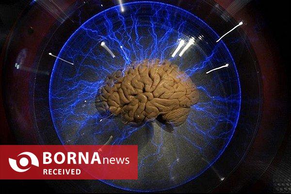 رمز و راز عملکرد مغز زیر ذرهبین محققان ایرانی رمز و راز عملکرد مغز زیر ذرهبین محققان ایرانی