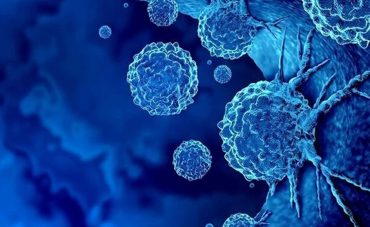 هوش مصنوعی حلال مشکلات سرطان