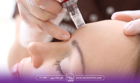 فرق مزوژل و مزوتراپی چیست؟