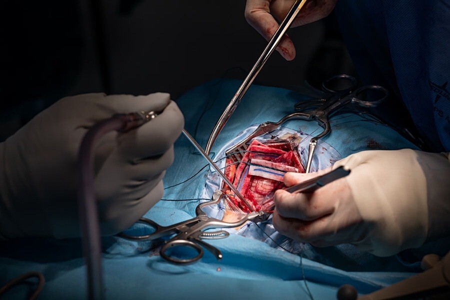 جراحی مغز؛ از تشخیص تا انتخاب بهترین جراح جراحی مغز؛ از تشخیص تا انتخاب بهترین جراح