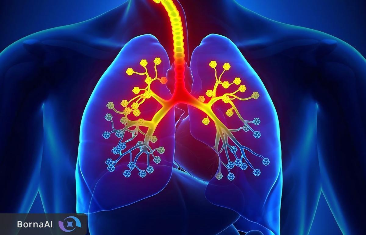 تولید داخلی داروی گران قیمت افنیب برای بیماران ریوی