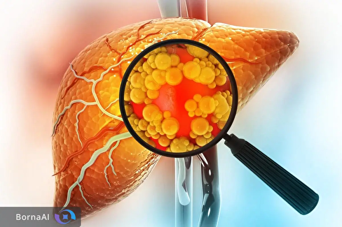 امید تازه برای پیشگیری از بیماری کبد چرب در کودکان