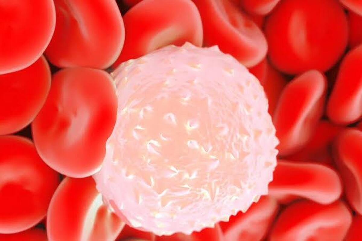 ابتلا به انواع عفونت‌ها با افت گلبول‌های سفید خون