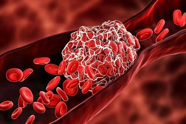 با این افشانه جدید خونریزی زخم در یک ثانیه بند می آید