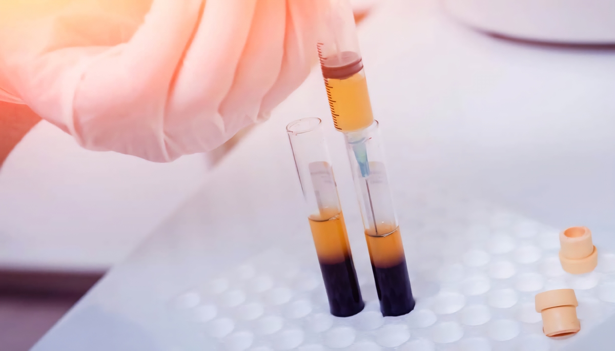 هدف‌گذاری تامین ۱.۵ میلیون لیتر پلاسما در کشور