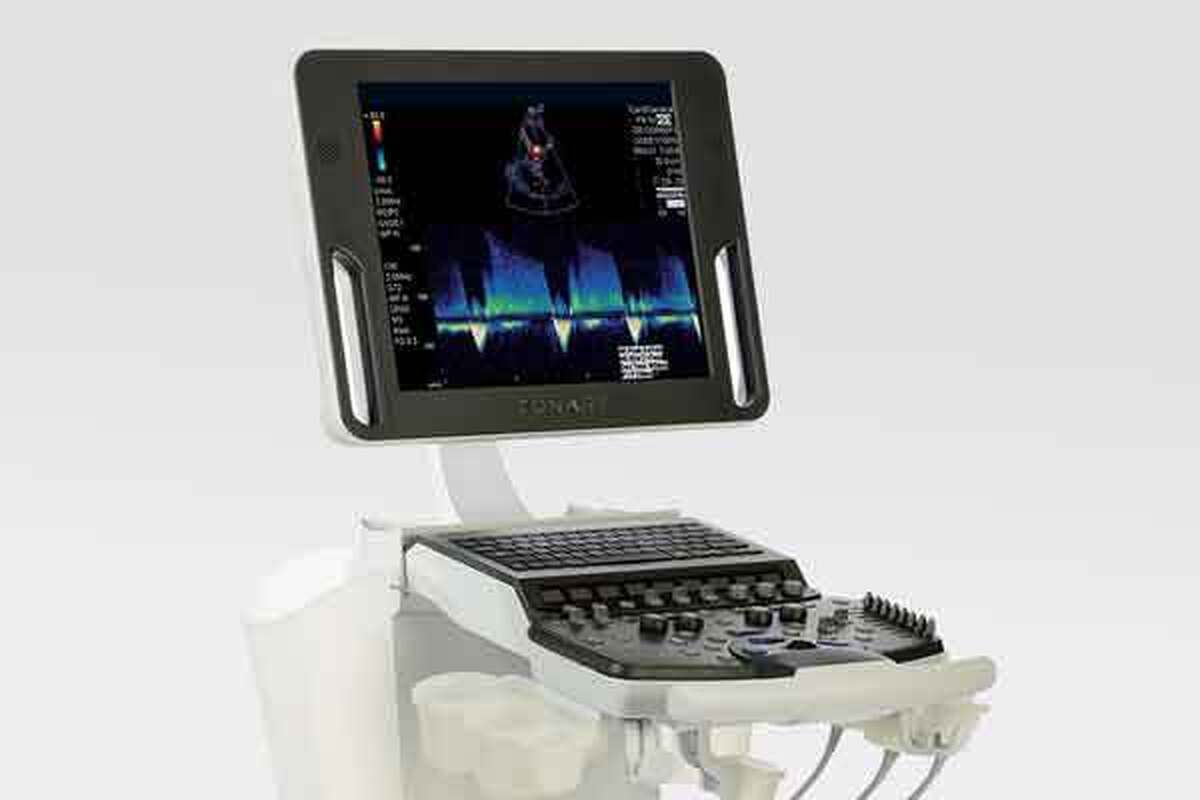 تجهیز بیمارستان حضرت زینب(س) اروندکنار به یک دستگاه اکوکاردیوگرافی