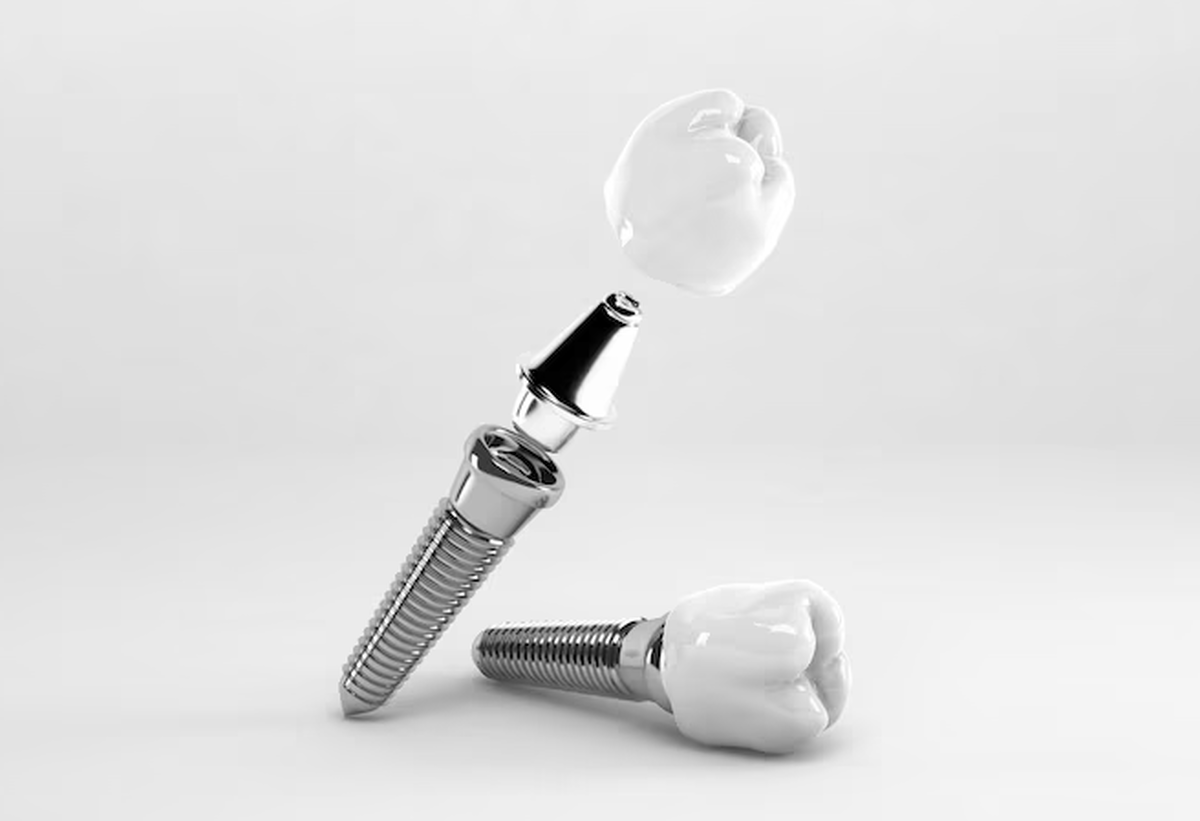 کاشت دندان طبیعی با سلولهای بنیادی؛ چه زمانی در ایران تجاری‌سازی می‌شود؟