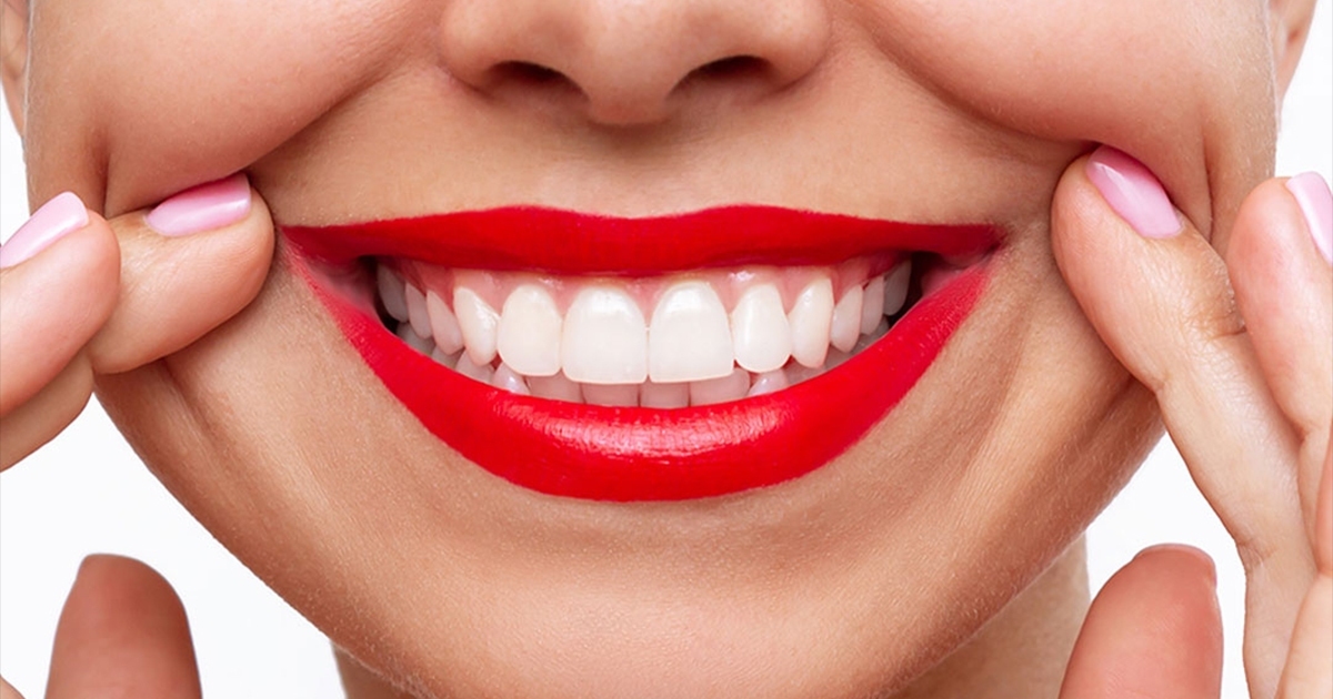 راز لبخند درخشان بازیگرا چیه؟ بلیچینگ دندان همین‌جاست!