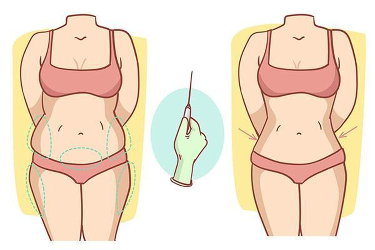 بهترین روش پیکرتراشی و بی‌خطرترین روش پیکر تراشی چیست؟