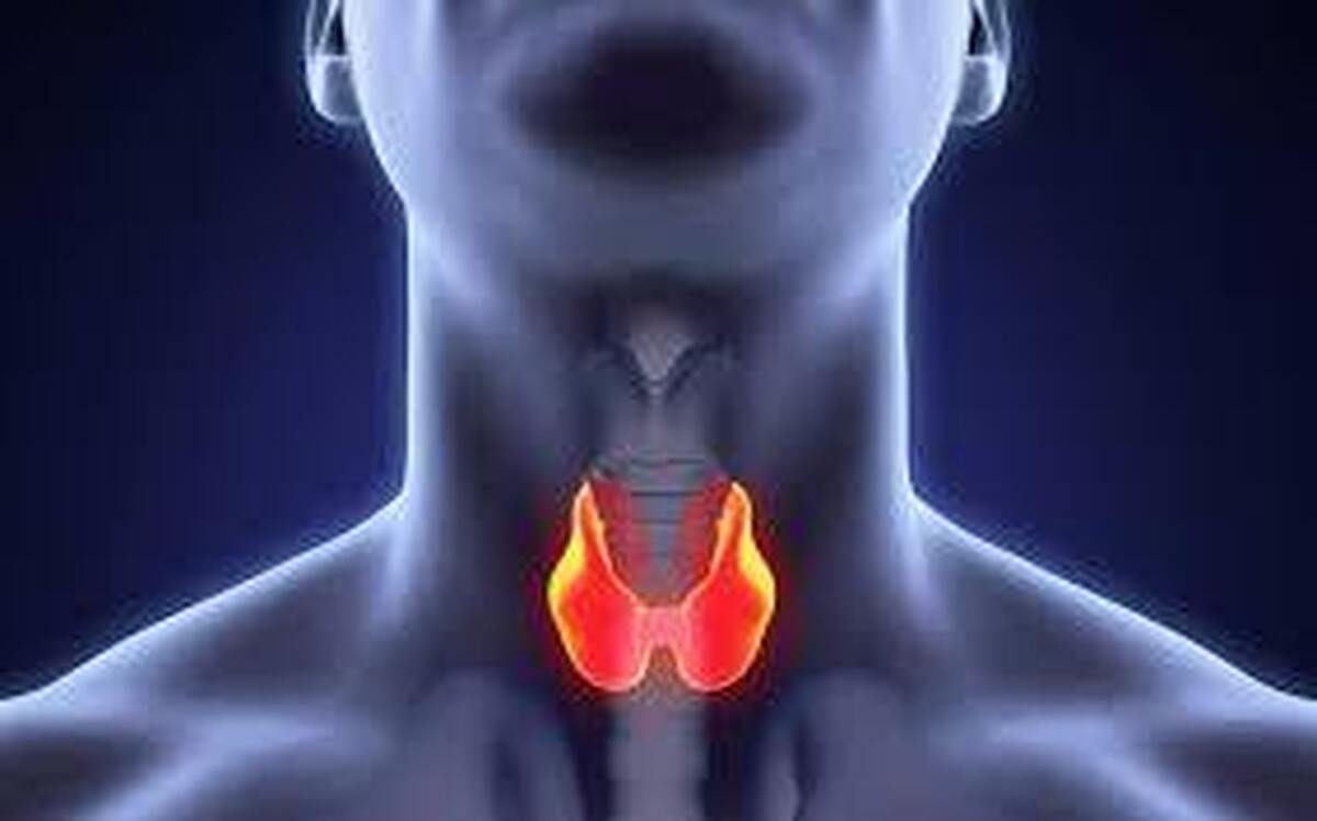 احتمال بالای ابتلا به کم‌کاری تیرویید در افراد گروه خونی O+ و شانس دو برابری ابتلا به سنگ کیسه صفرا