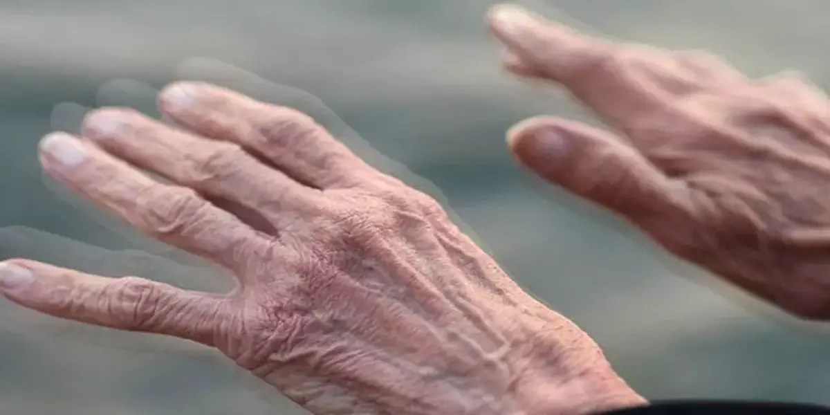 پارکینسون بیماری سالمندان/ شناسایی ۲۵۰ هزار مورد مبتلا به پارکینسون در کشور