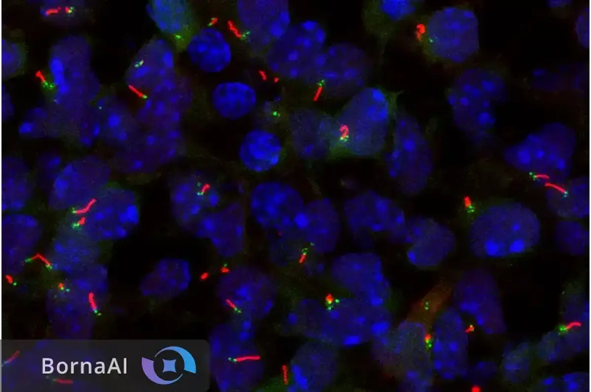 دو ژن رازآلودی که سلول‌ها را به آنتن مجهز می‌کنند