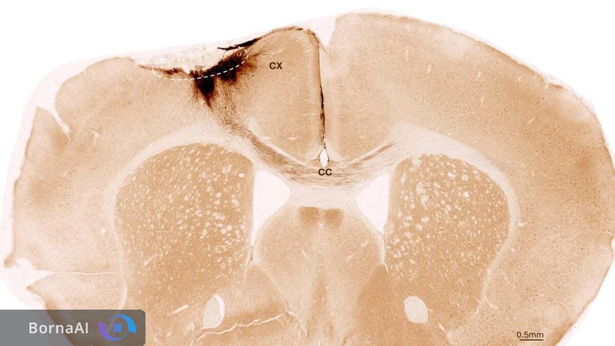 سلول‌های بنیادی آسیب سکته مغزی را معکوس کردند