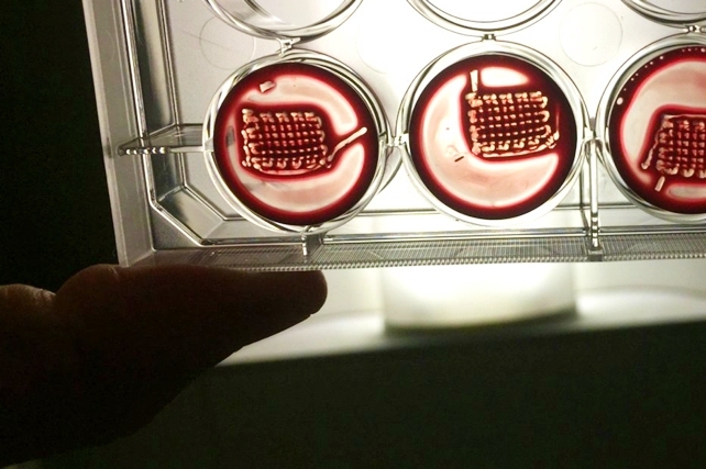 امید تازه‌ برای درمان پوکی استخوان