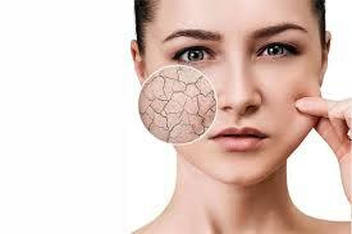 راهنمای کامل سلامت پوست، از روتین روزانه تا مقابله با خشکی و جوش